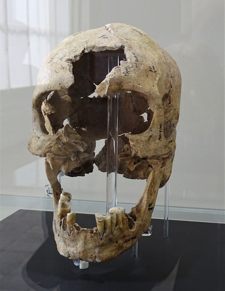 Human Skull and Mandible,7000-8000 BCE,National Museum of Iran
